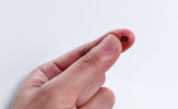 從手掌到手指方向進行揉搓,使穿刺部位滲出血滴。