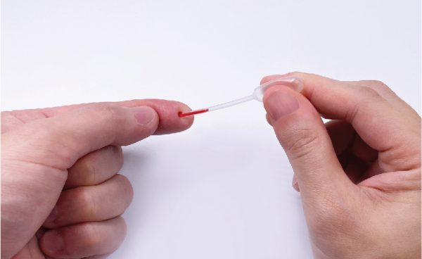 使用滴管在指尖上吸取血液,再把一滴血液加到檢測卡上的樣品槽(S)上。
如果第一次採血失敗,可以使用後備採血針重複步驟3-6。